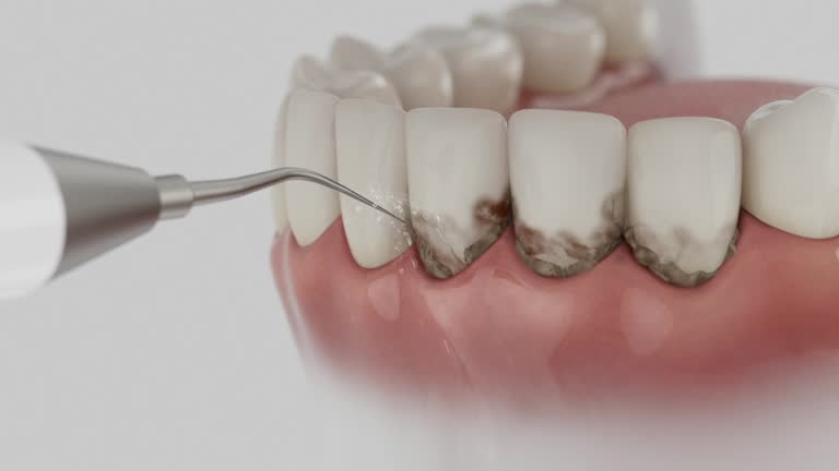 Reliable Dental Implants contractor in Strodes Mills, PA by Smile Center Dentistry